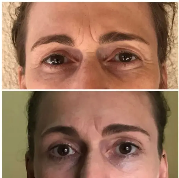 Antes e depois 44 anos
