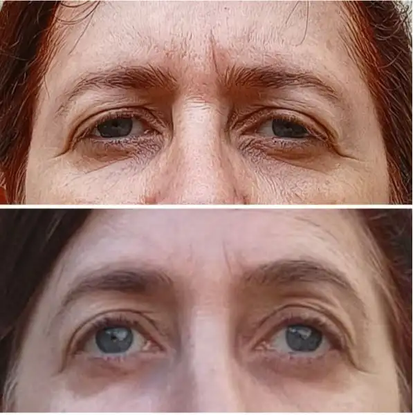 Antes e depois 54 anos