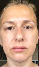 Liandra - antes